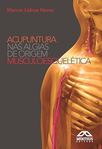 Acupuntura En Lesiones Musculoesqueleticas